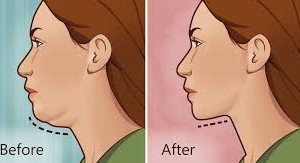 “Давхар” эрүү арилгах энгийн дасгал /бичлэг/